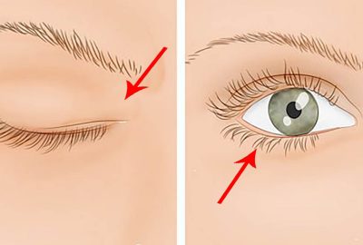 Việc liên tục nháy giật mắt có thể là lời cảnh báo sớm của 4 vấn đề bệnh tật này
